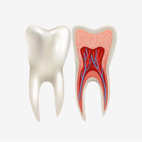 emergency root canal care in Pinellas County