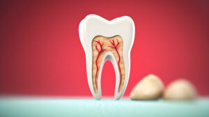 Endodontist in St. Petersburg